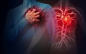 What Are the Early Signs of Heart Disease
